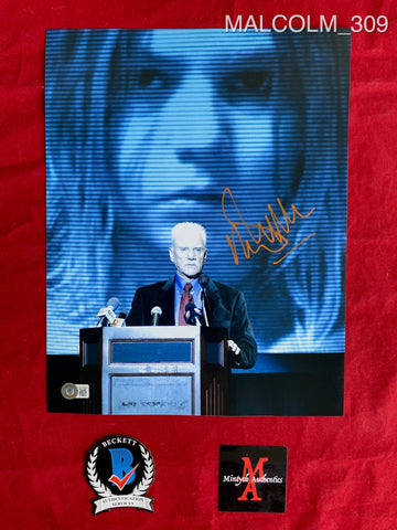 MALCOLM_309 - 11x14 Photo Autographed By Malcolm McDowell